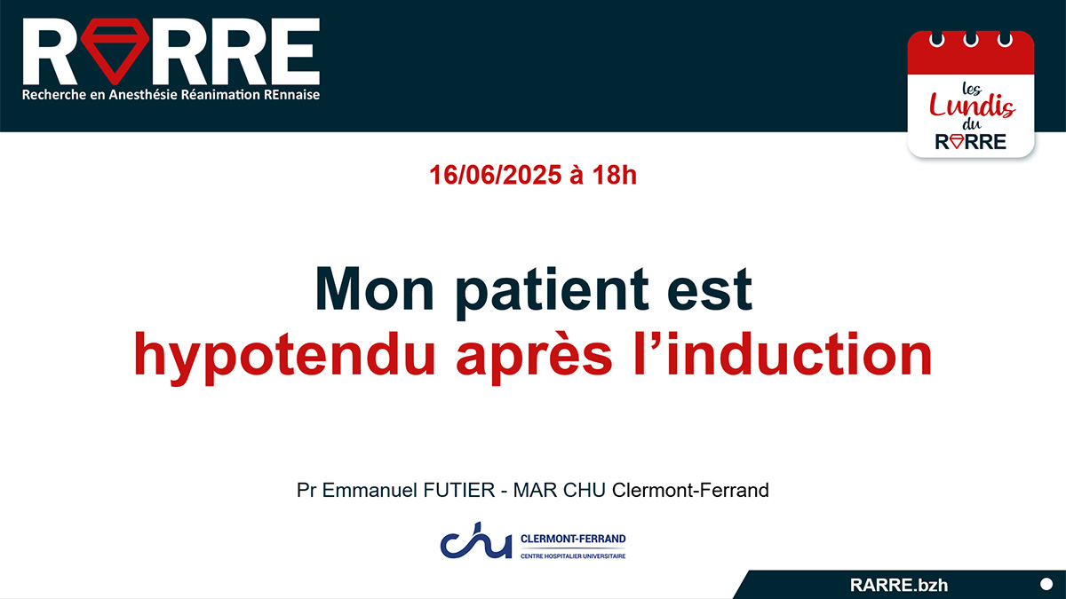 Lundi RARRE#33