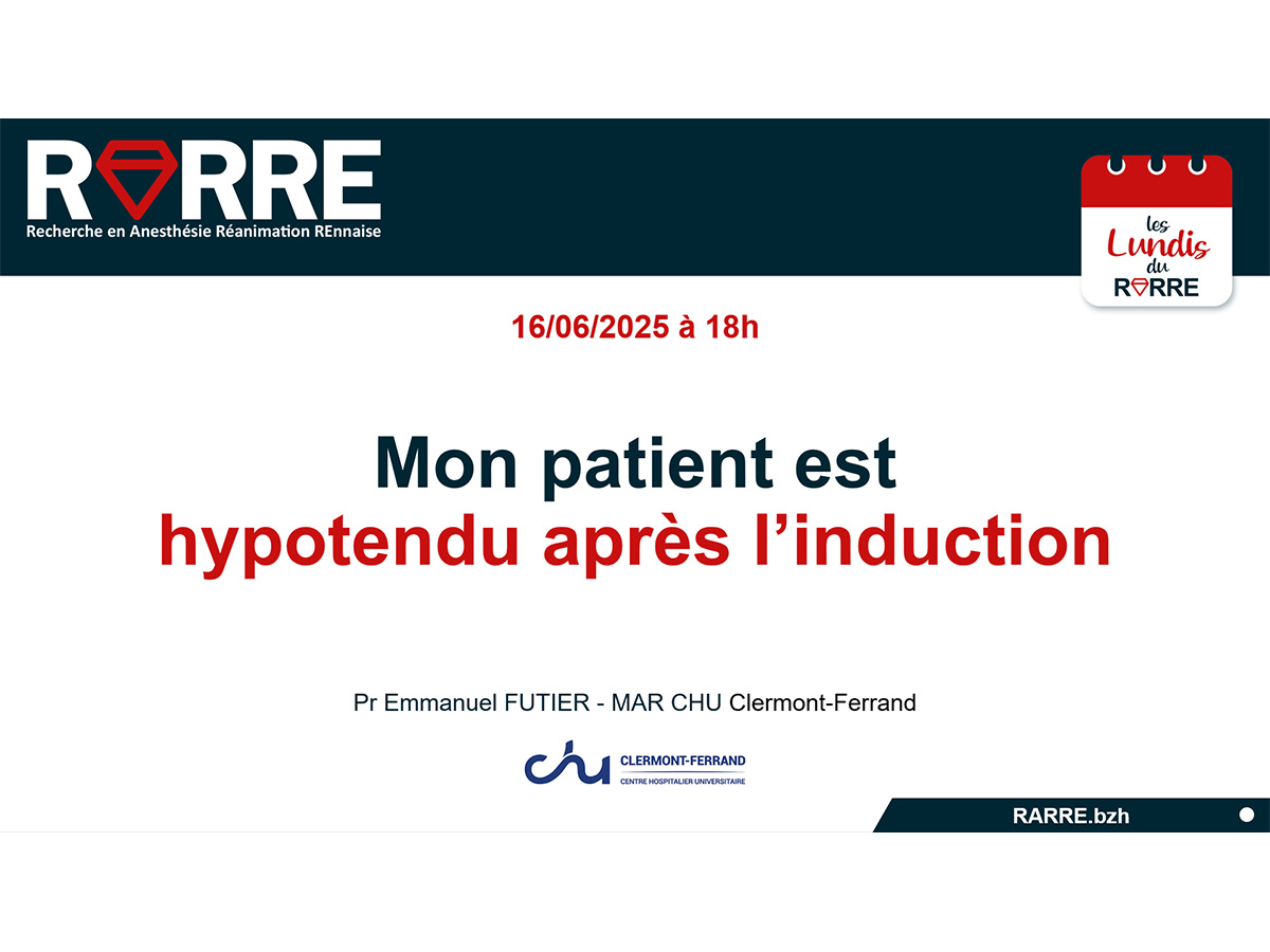 Lundi RARRE #33 16/06/25