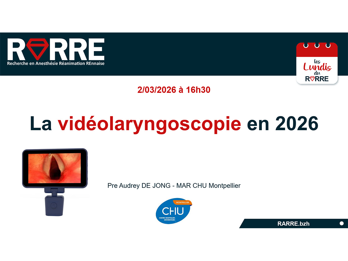 Lundi RARRE #40 2/03/26